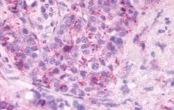 S1P2/EDG-5/S1PR2 Antibody, Novus Biologicals 50 &mu;g | Buy Online | Novus Biologicals | Fisher Scientific